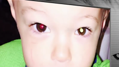 【健康】あなたのお子さんは大丈夫？ 「眼球のがん」のチェック方法