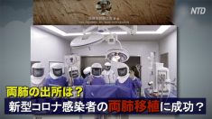 中国で新型コロナウイルス感染者の両肺移植に成功？ ネットユーザー「肺はどこから？」