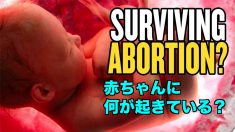 中絶を生き抜く：赤ちゃんに何が起きている？| America Uncovered